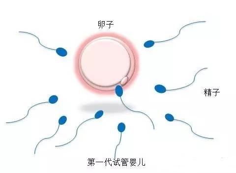 代怀供卵自怀医院